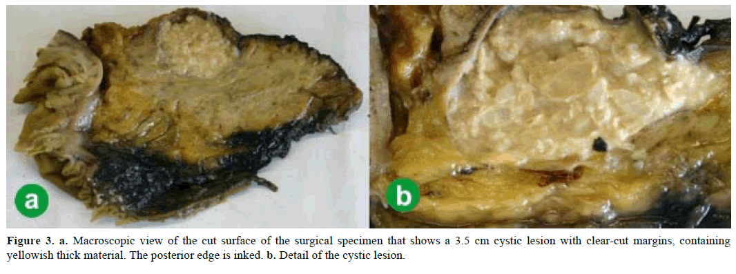 pancreas-macroscopic-view-cut-surface