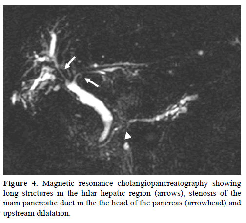 pancreas-magnetic-cholangiopancreatography