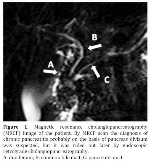 pancreas-magnetic-cholangiopancreatography