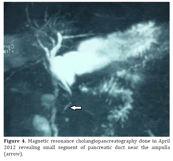 pancreas-magnetic-cholangiopancreatography