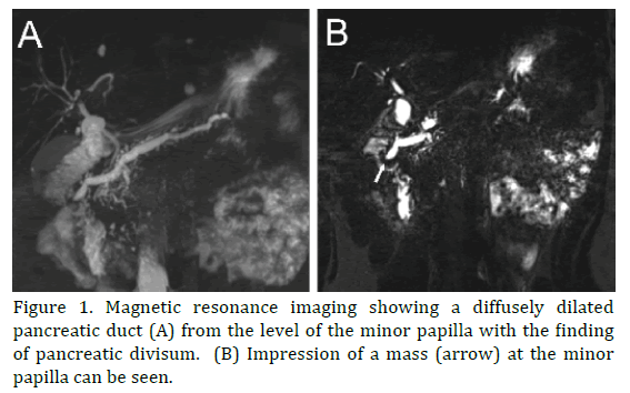 pancreas-magnetic-resonance