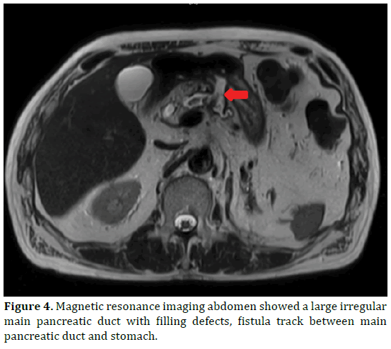 pancreas-magnetic-resonance