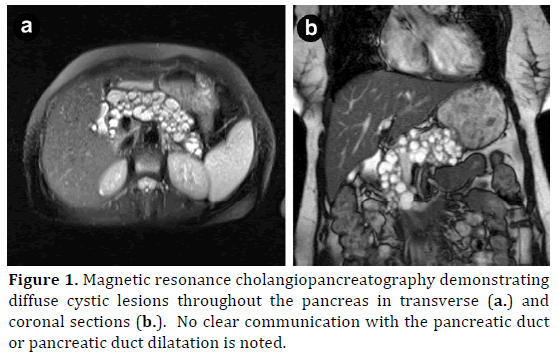 pancreas-magnetic-resonance-diffuse