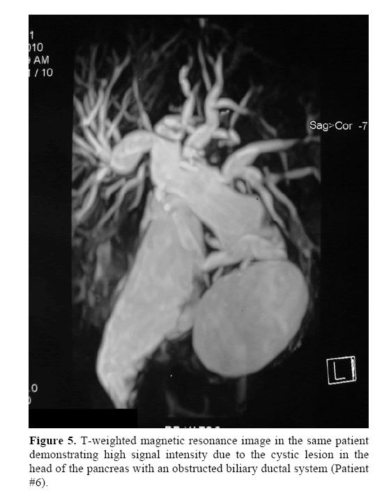 pancreas-magnetic-resonance-image