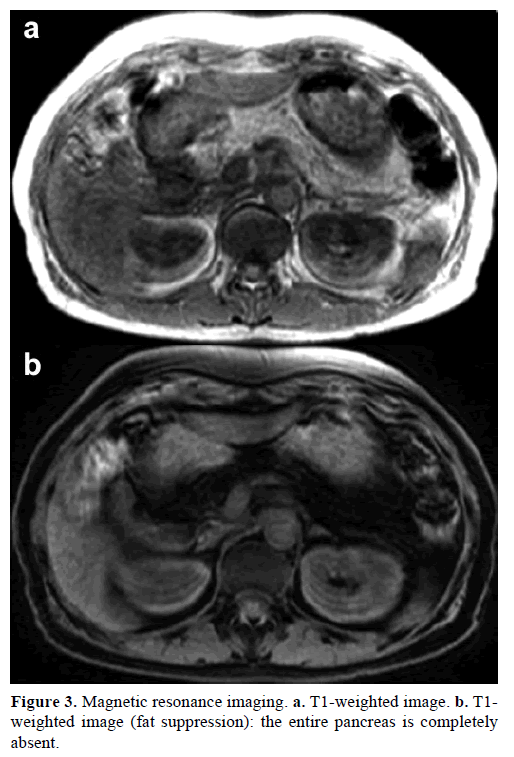 pancreas-magnetic-resonance-imaging