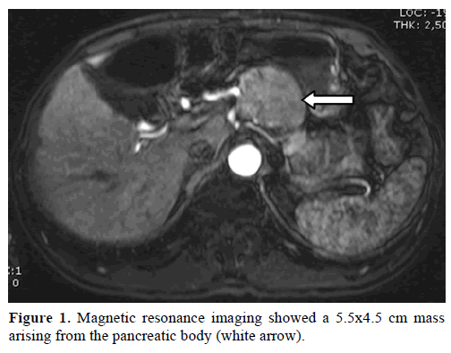 pancreas-magnetic-resonance-imaging