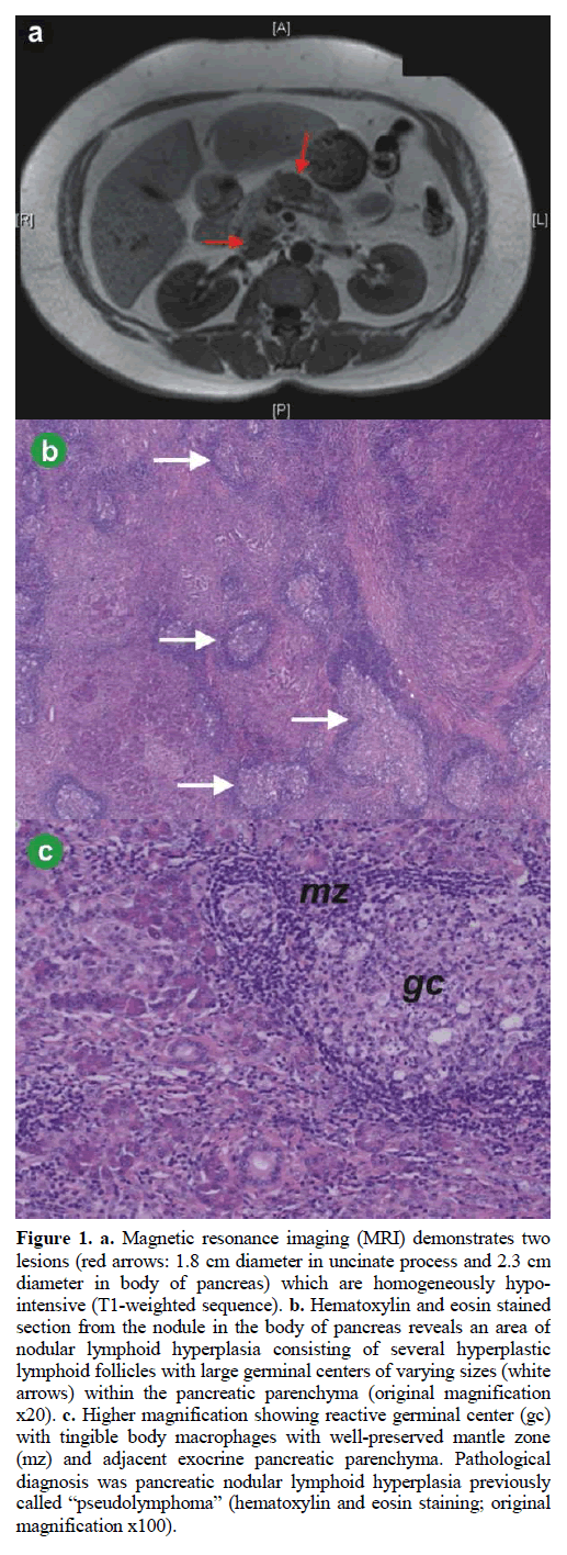 pancreas-magnetic-resonance-imaging