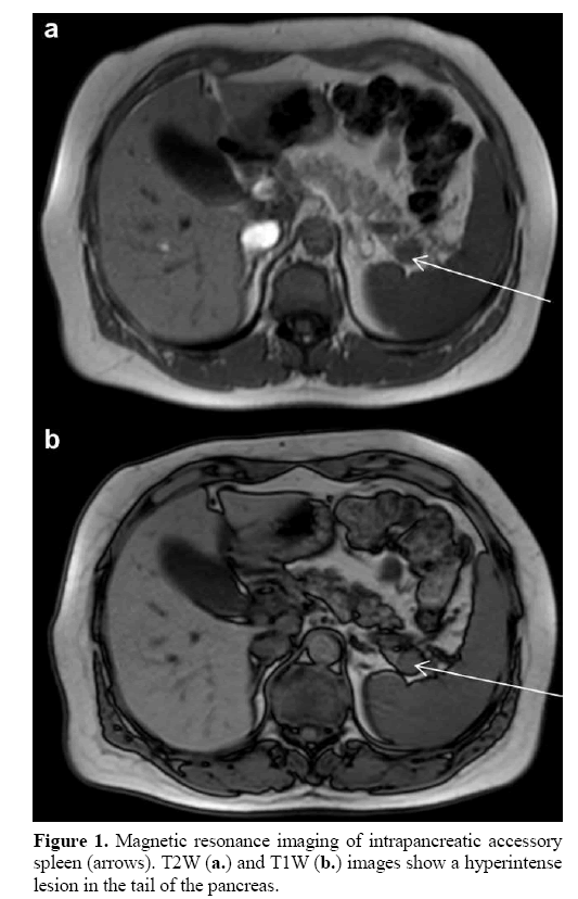 pancreas-magnetic-resonance-imaging