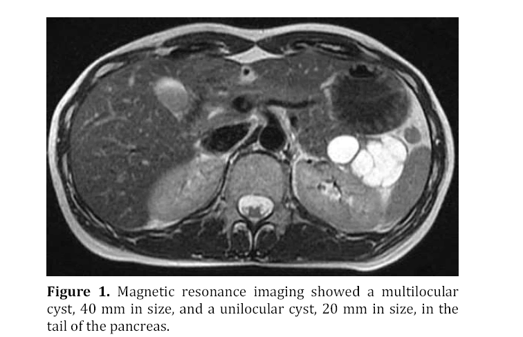 pancreas-magnetic-resonance-imaging