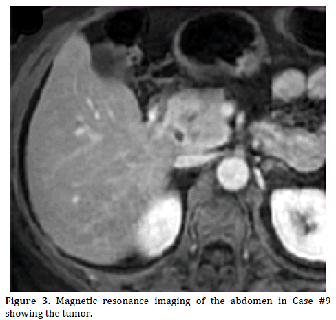 pancreas-magnetic-resonance-imaging