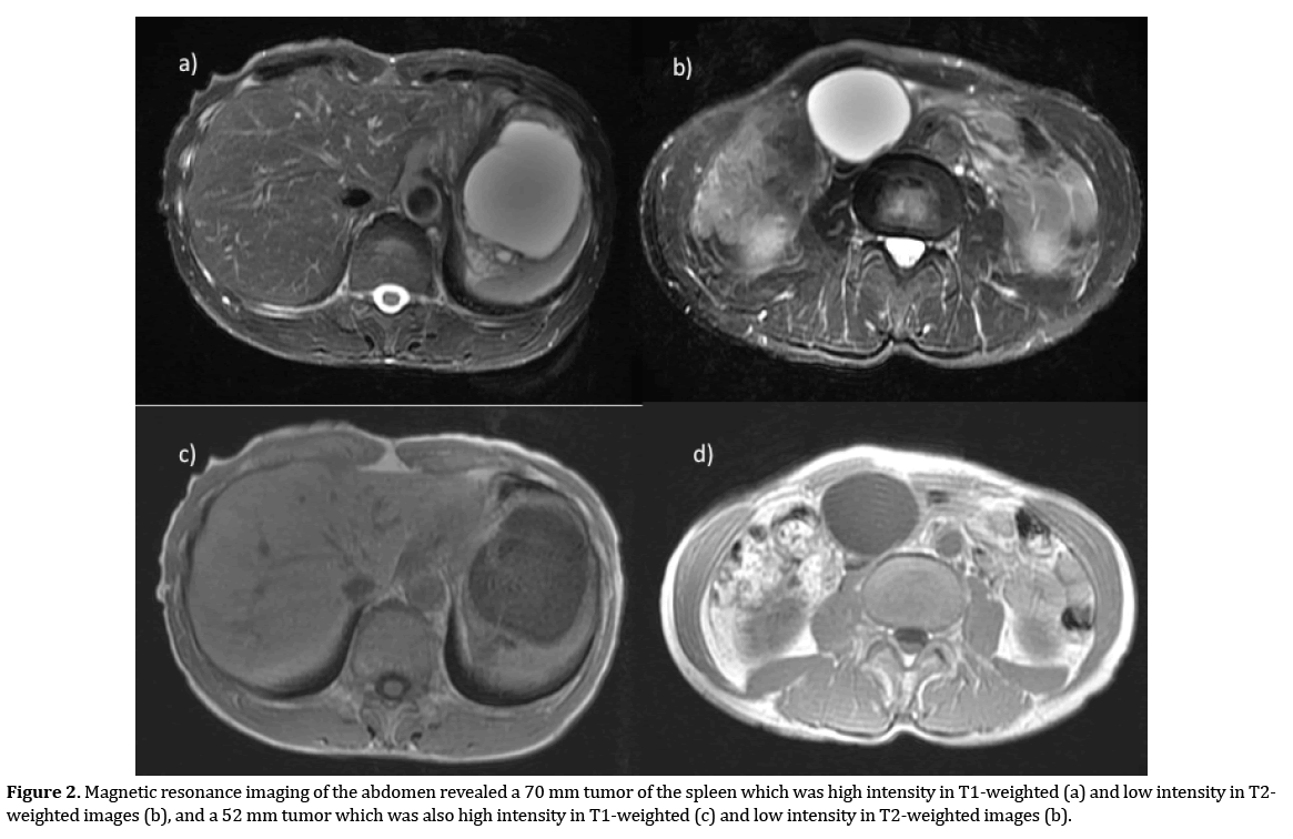 pancreas-magnetic-resonance-imaging