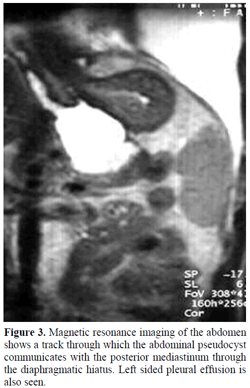 pancreas-magnetic-resonance-imaging