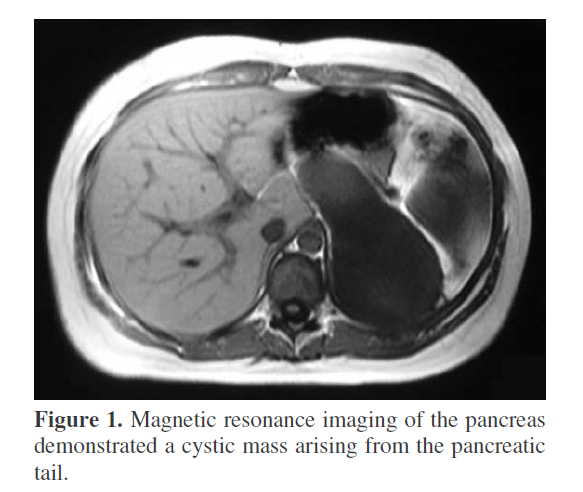 pancreas-magnetic-resonance-imaging