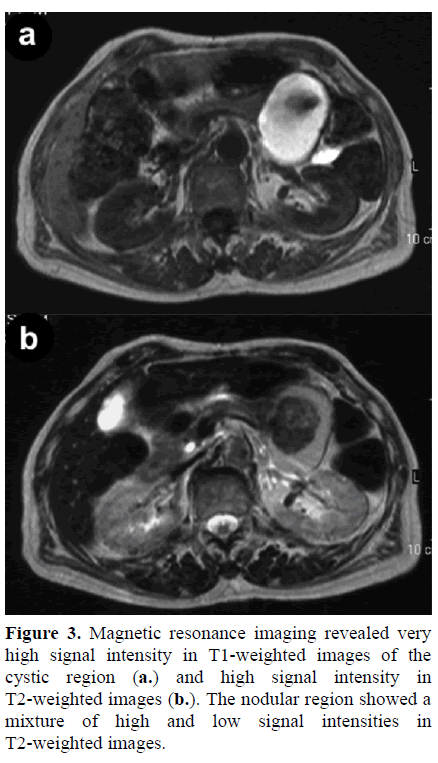 pancreas-magnetic-resonance-imaging-intensity