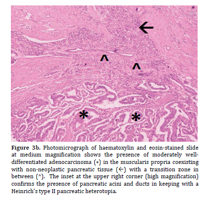 pancreas-magnification