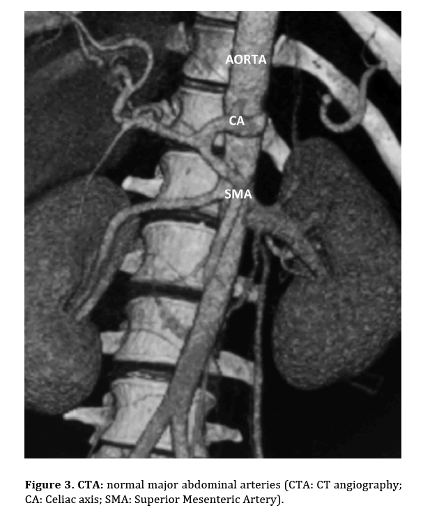 pancreas-major-abdominal-arteries