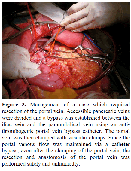 pancreas-management-accessible-pancreatic