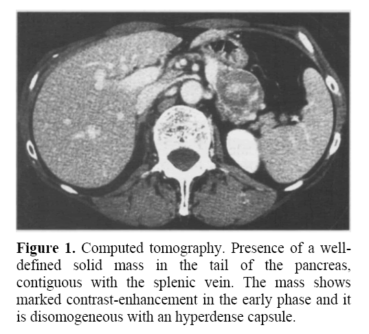 pancreas-marked-contrast-enhancement