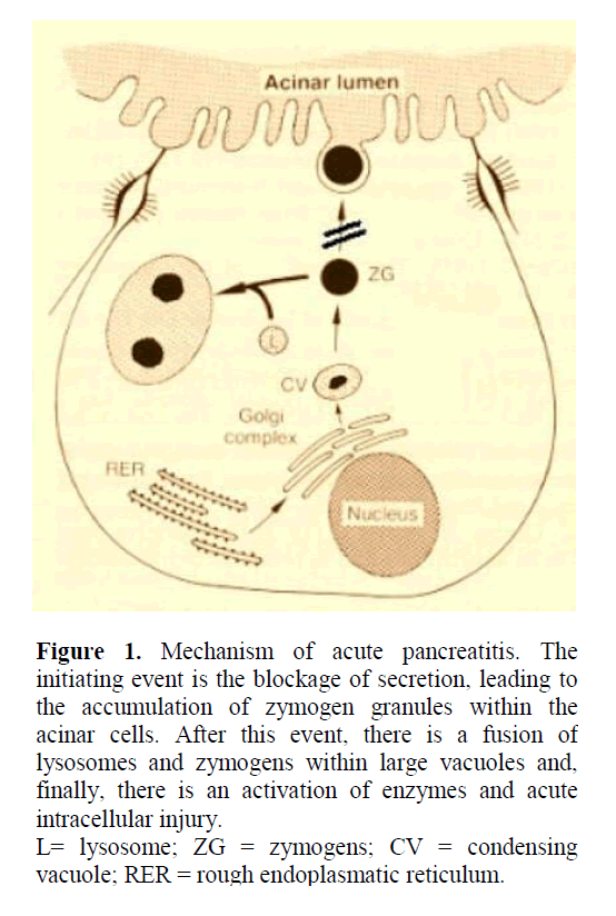 pancreas-mechanism-acute-pancreatitis