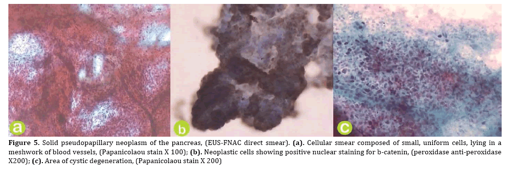 pancreas-meshwork