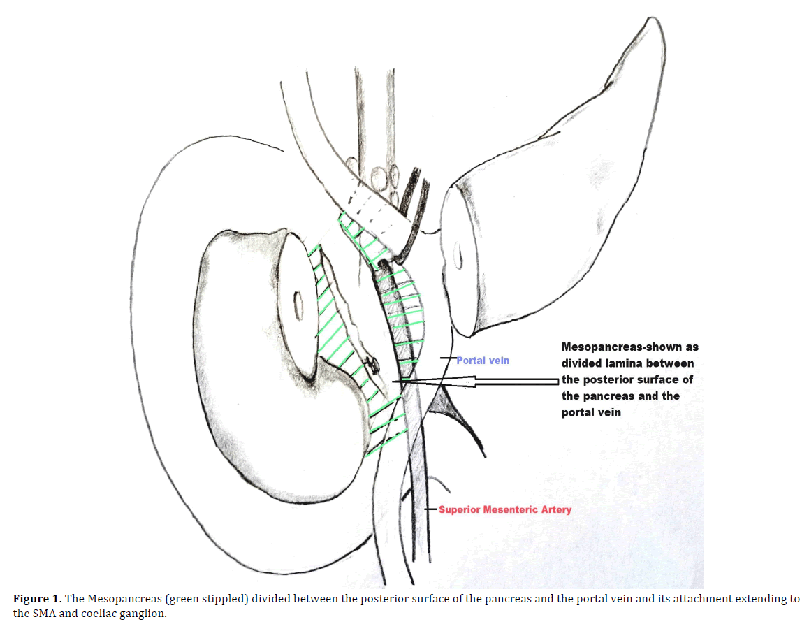 pancreas-mesopancreas-posterior-surface