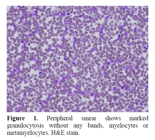 pancreas-metamyelocytes-H&E-stain