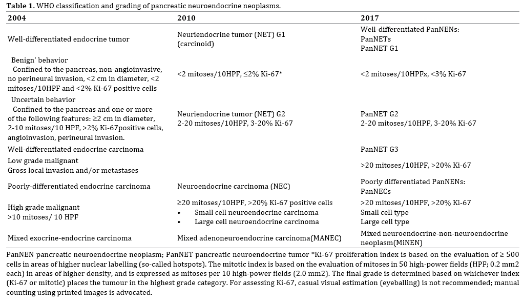 table