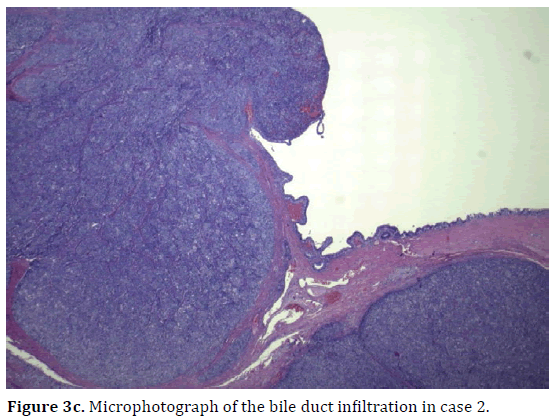 pancreas-microphotograph-bile-duct