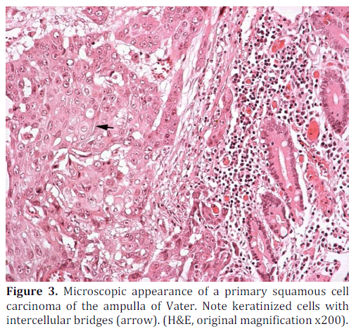 pancreas-microscopic-appearance