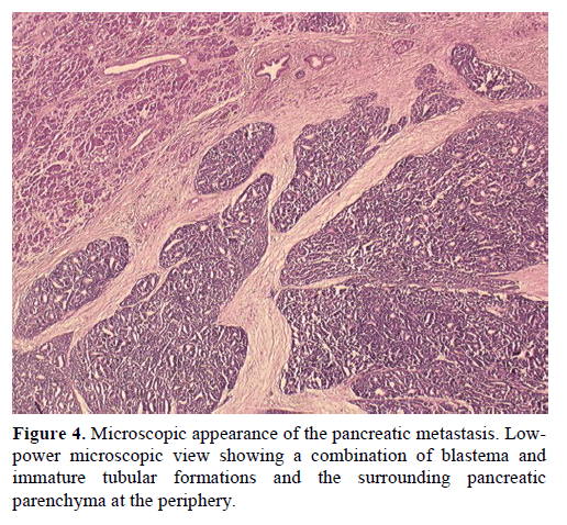 pancreas-microscopic-appearance-pancreatic