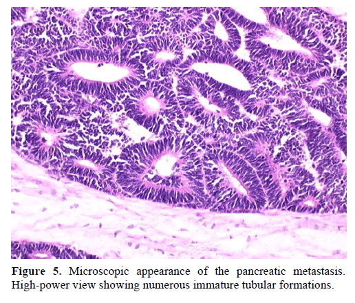 pancreas-microscopic-appearance-tubular