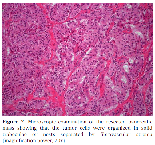 pancreas-microscopic-examination