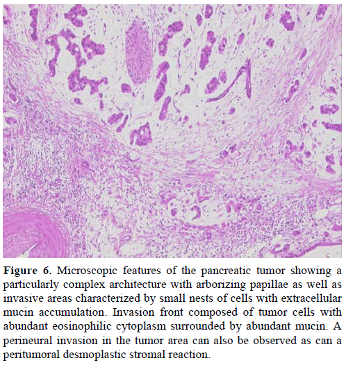 pancreas-microscopic-features-pancreatic