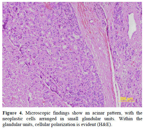 pancreas-microscopic-findings-show