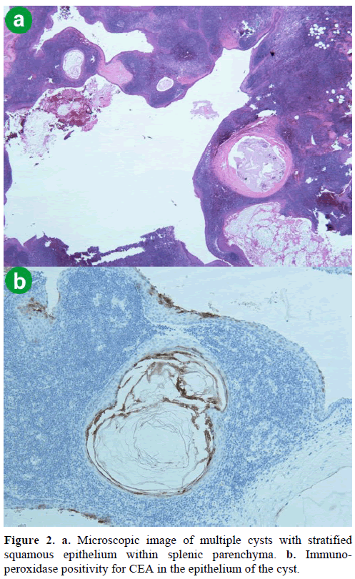 pancreas-microscopic-image-squamous