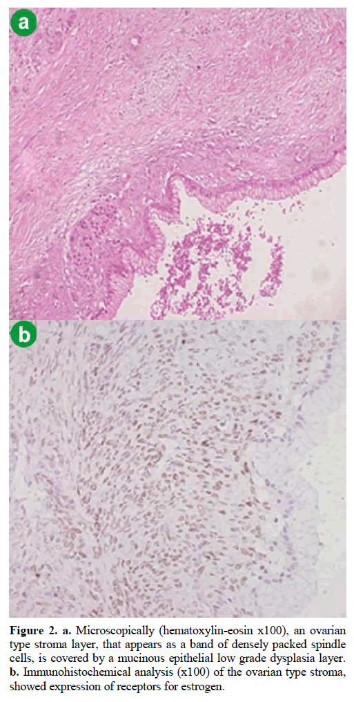 pancreas-microscopically-hematoxylin-eosin