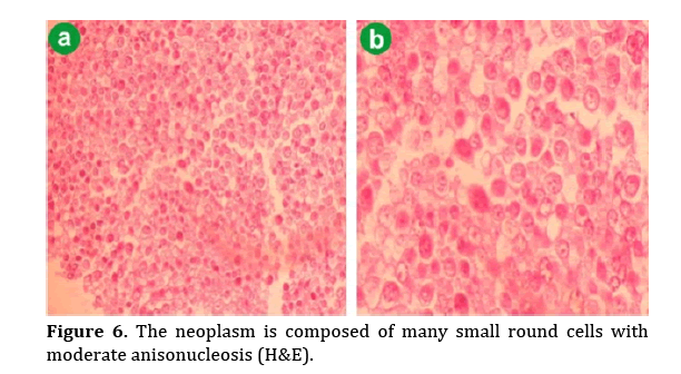 pancreas-moderate-anisonucleosis