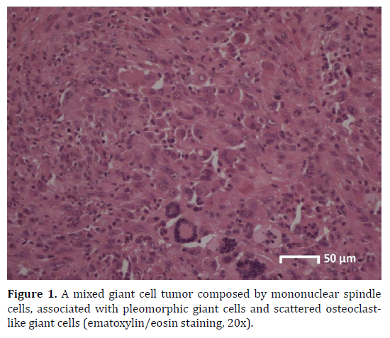 pancreas-mononuclear-spindle