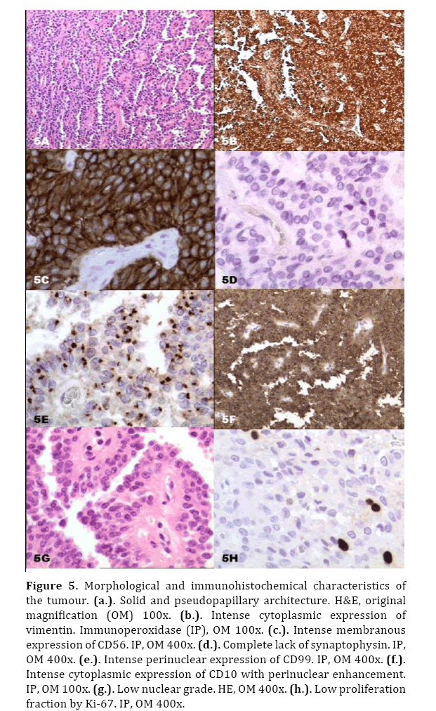 pancreas-morphological-immunohistochemical