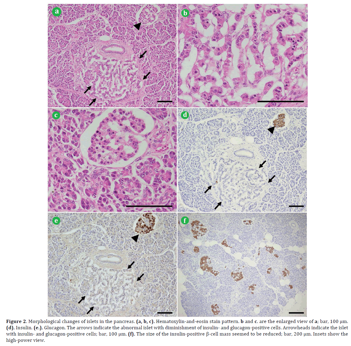 pancreas-morphological-pancreas-hematoxylin