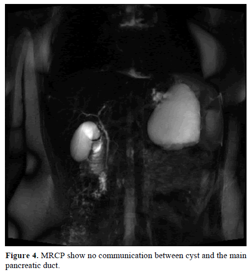 pancreas-mrcp-communication-pancreatic-duct