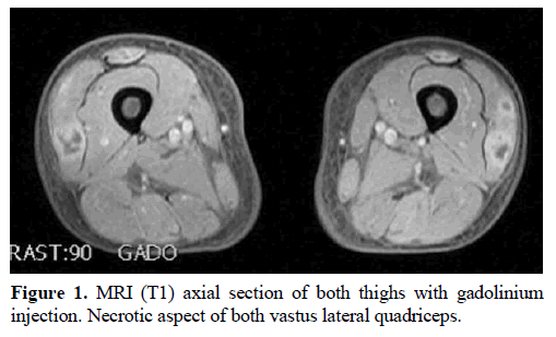 pancreas-mri-axial-section-gadolinium