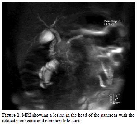 pancreas-mri-lesion-head-pancreas