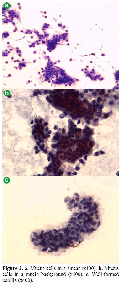 pancreas-mucus-cells-smear-papilla