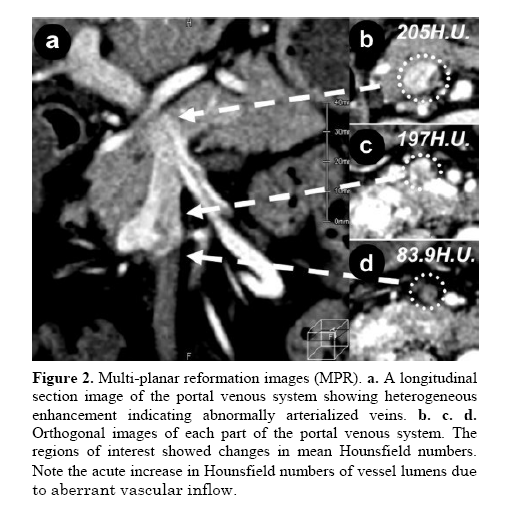 pancreas-multi-planar-reformation