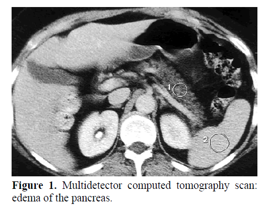 pancreas-multidetector-computed-tomography