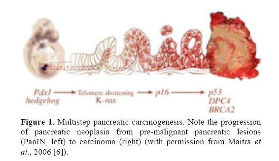 pancreas-multistep-pancreatic-carcinogenesis