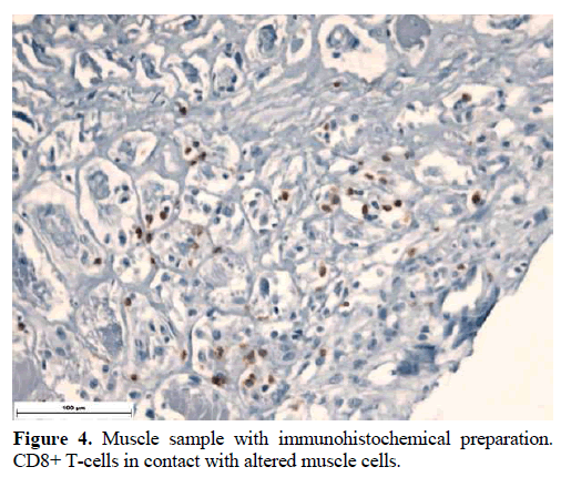 pancreas-muscle-immunohistochemical