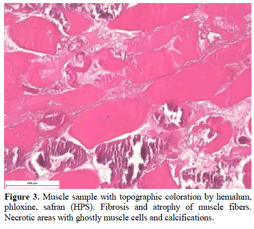 pancreas-muscle-sample-topographic