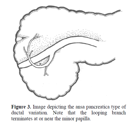 pancreas-near-minor-papilla